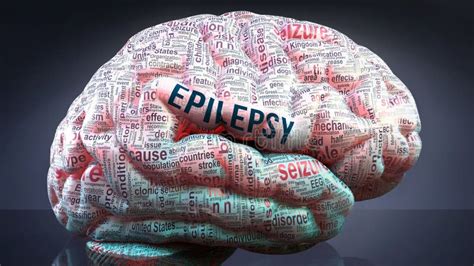 Epilepsy And A Human Brain Stock Illustration Illustration Of Concepts