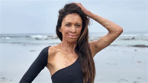 Turia Pitt On Her Superpower A Decade On From The Devastating Fire