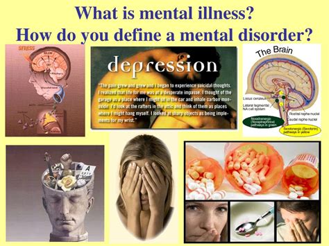 Ppt What Is Mental Illness How Do You Define A Mental Disorder