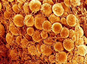 Brown fat is found in small animals from birth to adulthood. Delving into fat cell development | Broad Institute