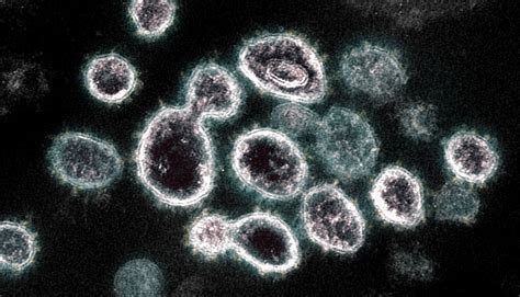 Coronaviruses Electron Microscope Cornoravirus Covid19 Pandemic 2020