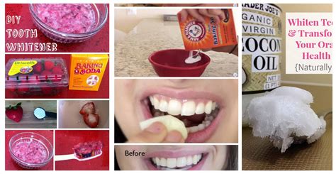 The Best Homemade Remedies To Whiten Your Teeth Naturally All For