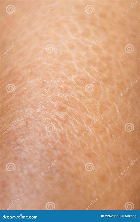 Dry And Cracked Skin Textures Close Up Stock Photo Image 22629560