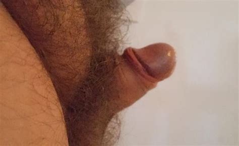 Very Small Erect Penis Micropenises