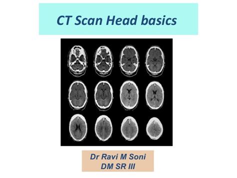 Ct Scan Head Basics