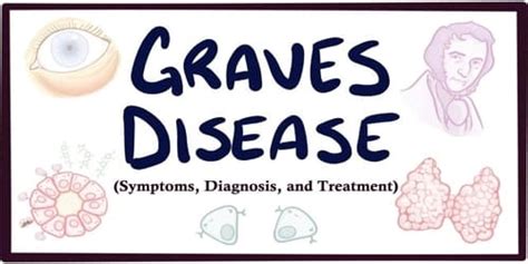 Graves Disease Symptoms Diagnosis And Treatment Assignment Point