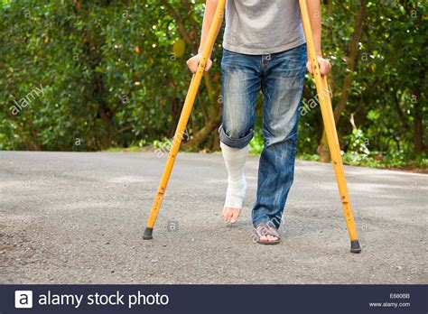 Broken Leg Crutches Hi Res Stock Photography And Images Alamy