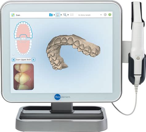 Itero Scanner Orthodontics Limited