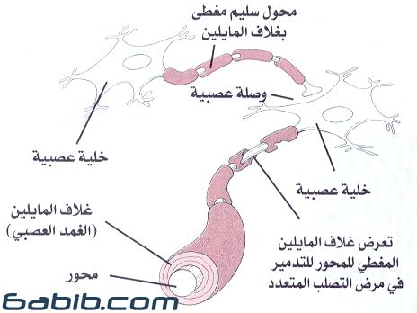 التمرين المستمر مهم للحفاظ على الصحة البدنية والعقلية ، حتى لو كان الشخص يعاني من إعاقة. التصلب المتعدد MS - Multiple sclerosis | طبيب