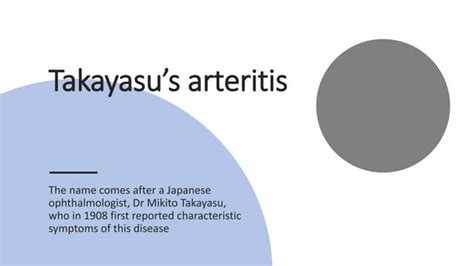 Takayasu Arteritis Ppt