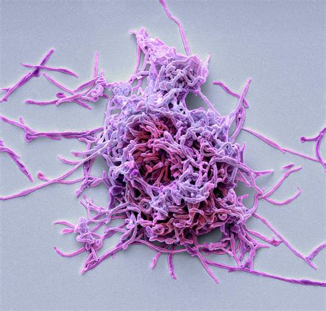 Mycoplasma Pneumoniae 3 Photograph By Steve Gschmeissner Pixels