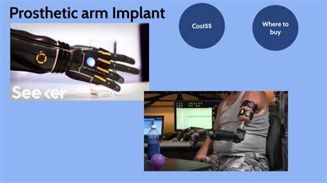 Prosthetic Arm Implant By Callie Smith On Prezi Next