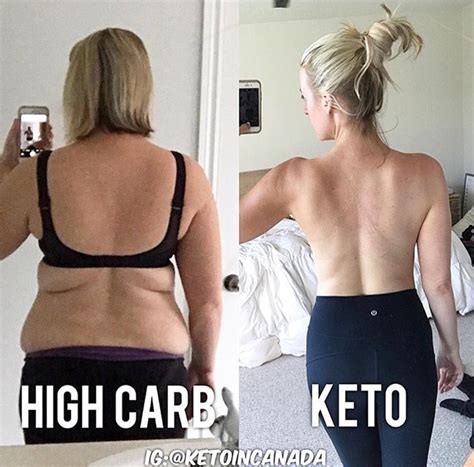 38 Incredible Keto Diet Before And After Pictures Ketolc Diet Diet