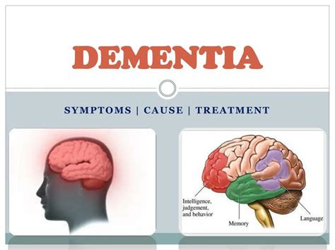 Ppt Dementia Symptoms Causes And Treatment Powerpoint Presentation