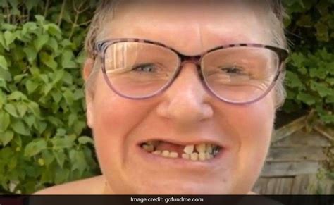 Uk Woman Couldnt Find A Dentist So She Pulled Out 13 Of Her Own Teeth