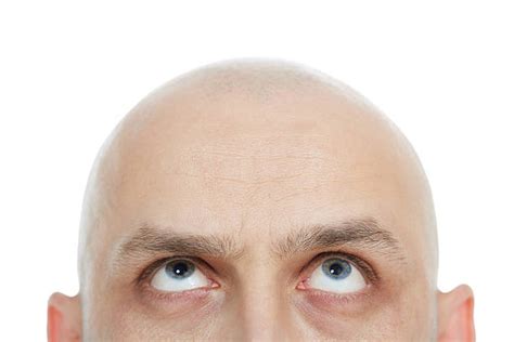 Bald Head Stock Photos Pictures And Royalty Free Images Istock