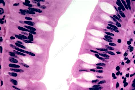 Simple Columnar Epithelium Under Microscope