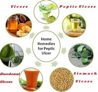 Diet with duodenal ulcer is one of the most important components of treatment. Home Remedies For Peptic Ulcer That Give Amazing Results ...