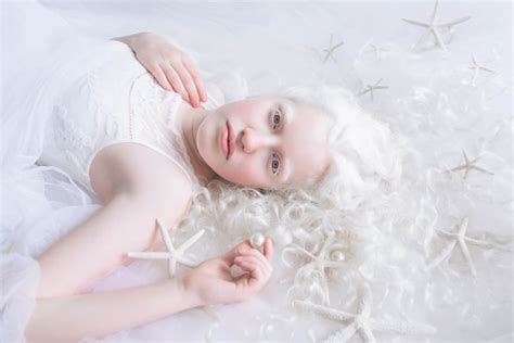 Albinism Photographs Yulia Taits Part Popsugar Beauty