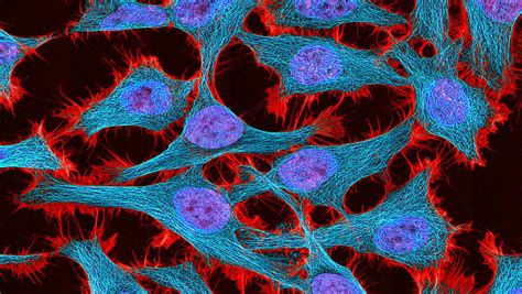You and your doctor will discuss what cholesterol medications are right for you based on your current and past medical history, your current health, and any other. Do cancer cells prefer fat to sugar? - Futurity