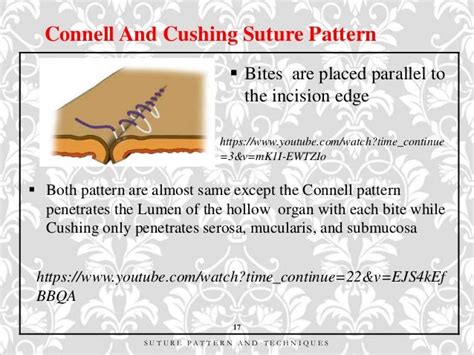 Connell Suture Pattern