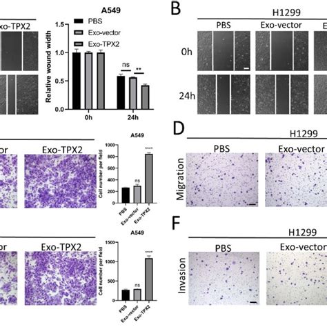 Exosomes From Cells With High Tpx Expression Promote Cell Invasion And