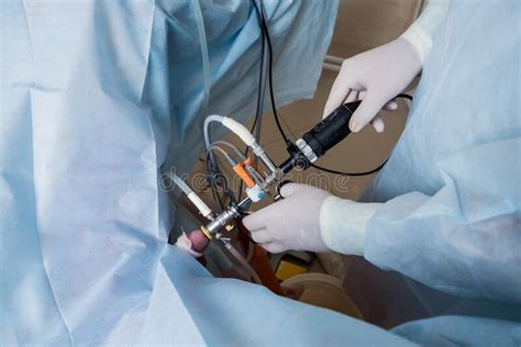 Process Of Urological Surgery Operation Using Laparoscopic Equipment