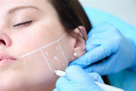 Botox Injections For Tmj And Bruxism Grinding Of Teeth