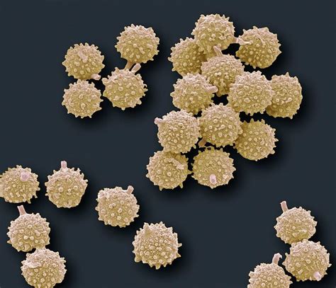 Puffball Fungus Spores, Sem Photograph by Steve Gschmeissner