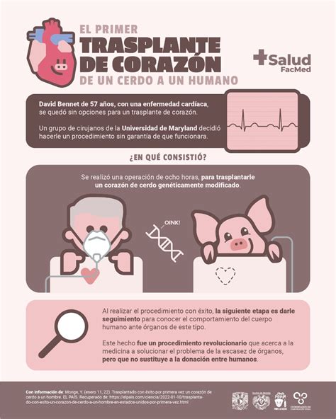 Primer Trasplante De Corazón De Cerdo A Un Humano Salud Facmed