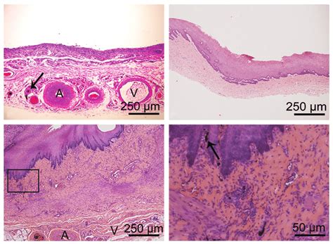 Representative Histology Of A The Capsule B Buccal Mucosa Graft