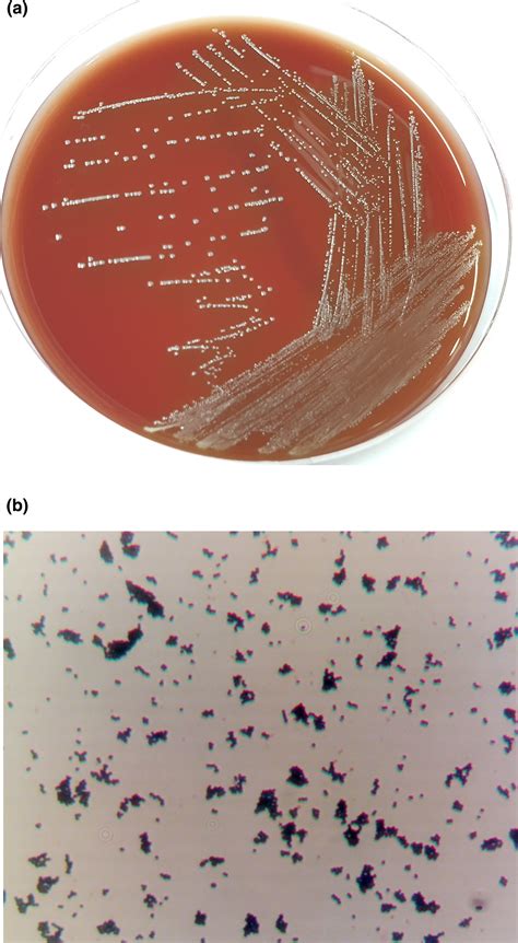 Characteristics Of Aerococcus Viridans Isolated From Porcine Fetuses In Korean Farms Nguyen