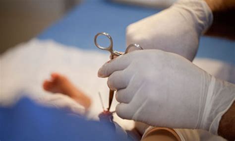 La Circoncision En France Illégale Mais Admise