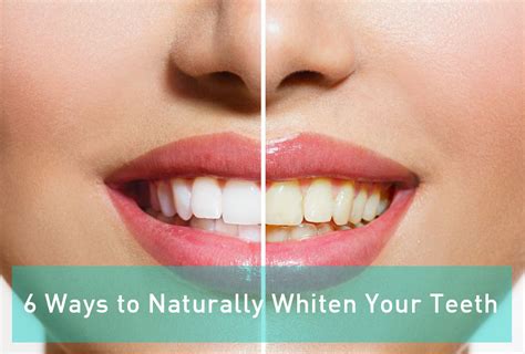 6 Ways To Naturally Whiten Your Teeth