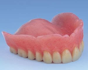 Check spelling or type a new query. Permanent Dentures San Diego | IDIA | The Dental Implant Guide
