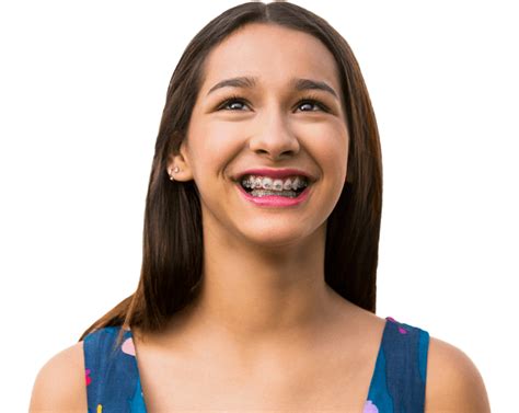 Nhs Treatment Braces On The Nhs Chesterfield Orthodontics