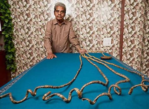 Indian Man With Guinness World Record Longest Nails Cuts Them After 66
