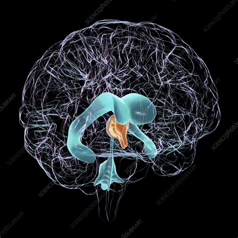 Enlarged Third Ventricle Of The Brain Illustration Stock Image