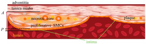 Bioengineering Free Full Text A New Conformal Penetrating Heating