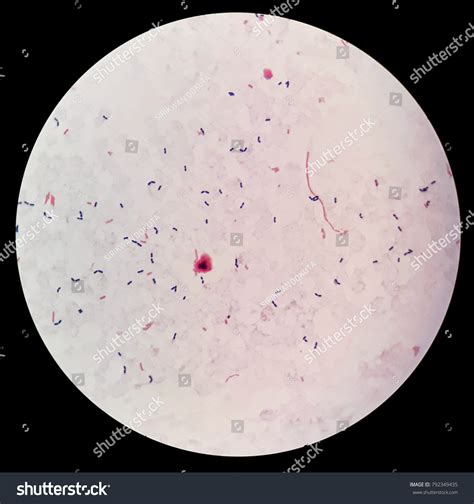 185 Gram Negative Bacteria Under 100x Images Stock Photos And Vectors