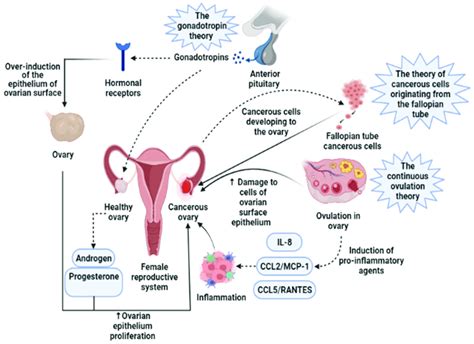Three Main Theories Regarding The Development Of Ovarian Cancer Are