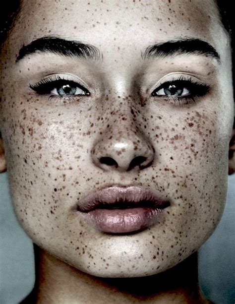 What Are Freckles Fashionsizzle