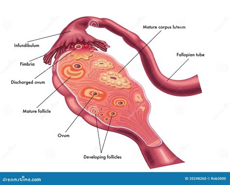 Ligamento Suspensor Do Ovario