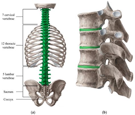Materials Free Full Text Materials For The Spine Anatomy Problems