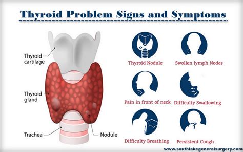 Know More About Thyroid Treatment And Surgery Southlake General Surgery
