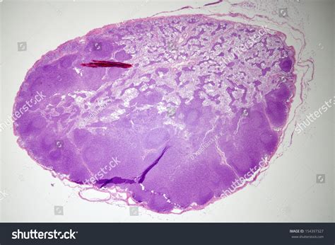 Microscopic View Lymph Node Stock Photo Edit Now 154397327