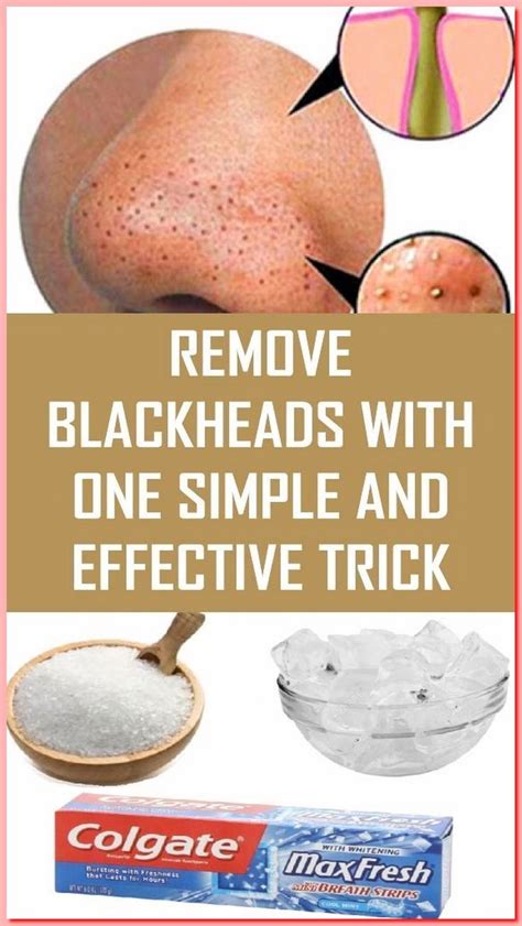 Remove Blackheads With One Simple And Effective Trick
