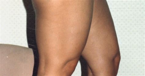 Her Calves Muscle Legs Countess Denica Mistress With Muscular Calves
