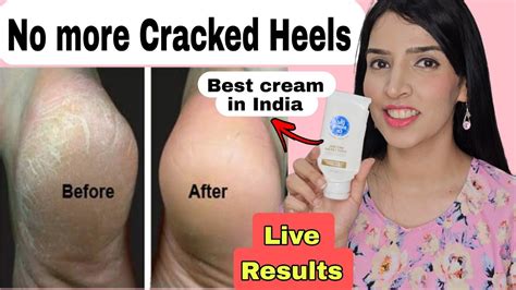 The Moms Co Foot Cream Review Cream For Dry Cracked Heels Best Cream For Cracked Heels In