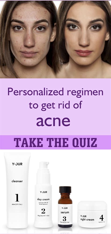 Personalized skin care routine to get rid of acne Skin Care Regimen